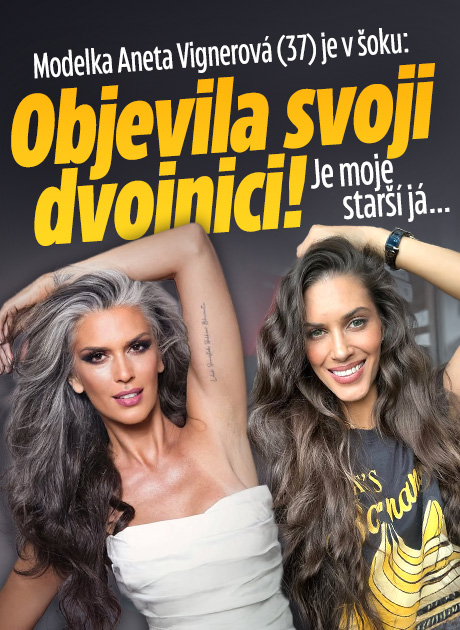 Banner ke žhavému tématu: Modelka Aneta Vignerová je v šoku: ...