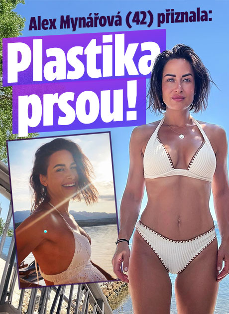 Banner ke žhavému tématu: Alex Mynářová kápla božskou: Plastika ...