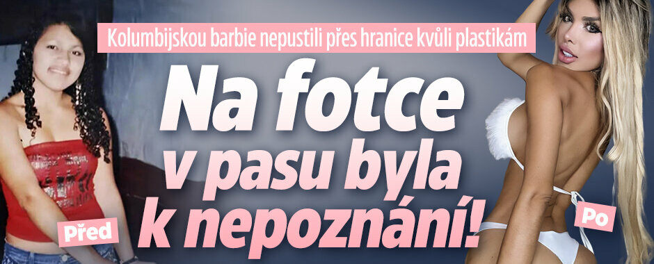 Kolumbijskou Barbie nepustili přes hranice kvůli plastikám: Na fotce v pasu byla k nepoznání! Kolumbijskou Barbie nepustili přes hranice kvůli plastikám: Na fotce v pasu byla k nepoznání!