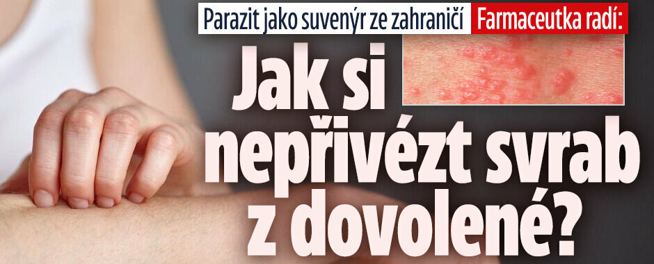 Svrab jako suvenýr z dovolené: Zapomeňte na samoléčbu, zapojte odborníky