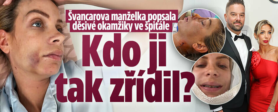 Švancarova manželka Kamila je po náročném zákroku:  Posouvali jí čelisti