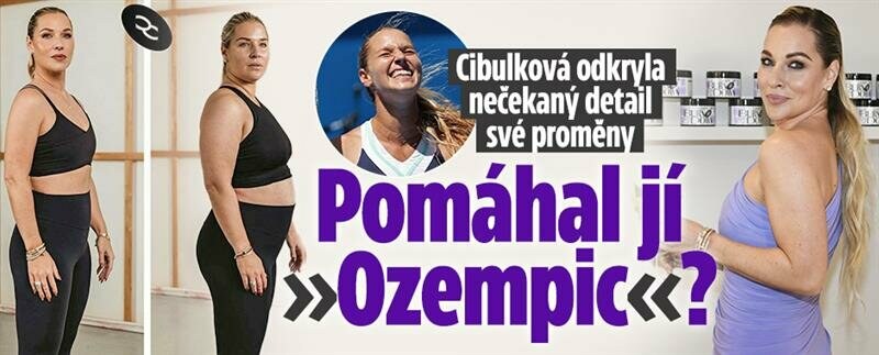 Cibulková odkryla nečekaný detail své proměny: Pomáhal jí »Ozempic«?