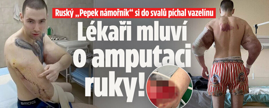 Ruský „Pepek námořník“ si do svalů píchal vazelínu: Lékaři teď mluví o amputaci ruky!