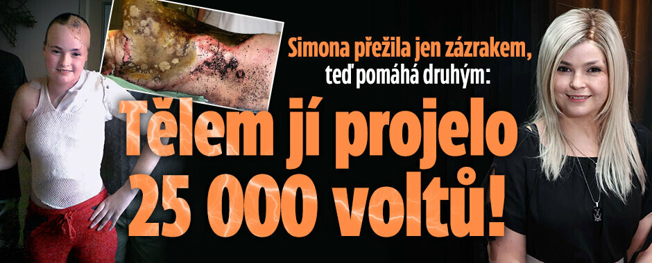 Tělem jí projelo 25 000 voltů. Přežila jen zázrakem, dnes Simona pomáhá druhým