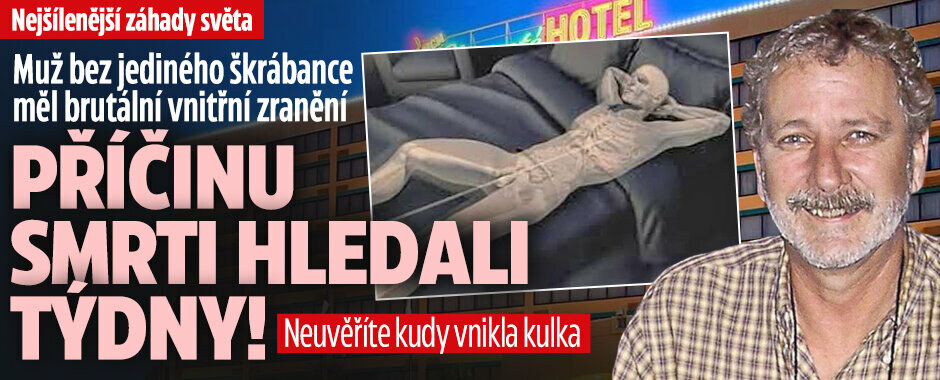 Nejšílenější záhady světa: Muž bez jediného škrábance měl brutální vnitřní zranění. Příčinu smrti hledali týdny! Neuvěříte, kudy vnikla kulka