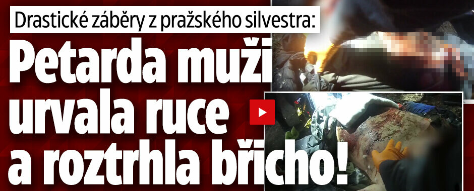 Drastické záběry: Výbuch petardy muži (46) v Praze amputoval ruce a roztrhl břicho!