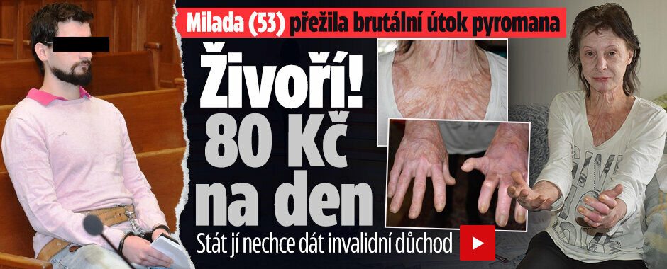 Miladu (53) málem upálil kriminálník: Živořím, stát mi neuznal invalidní důchod!