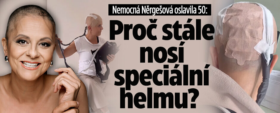 Nemocná Něrgešová oslavila 50: Proč musí nosit speciální helmu?