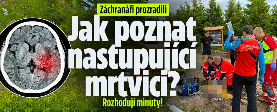 Záchranáři prozradili: Jak poznat nastupující mrtvici? Rozhodují minuty!