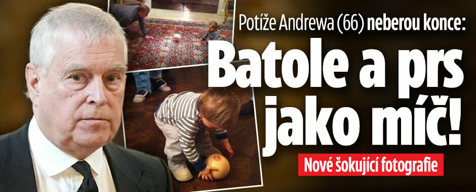 Potíže Andrewa (66) neberou konce: Batole a prs jako míč! Nové šokující fotografie