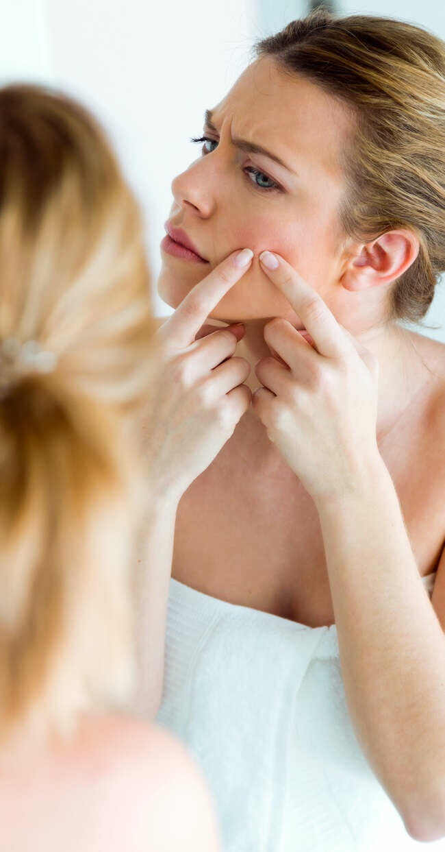 Akné umí potrápit i v dospělosti: Pomůžou náplasti, krémy nebo obyčejná pasta na zuby?