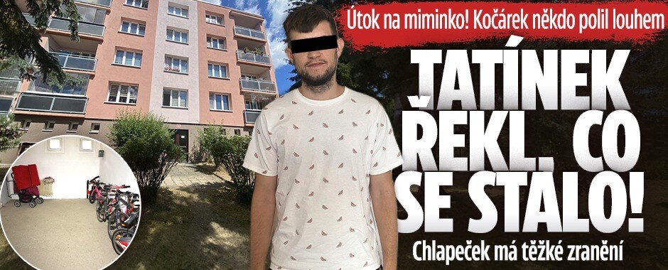 Útok na miminko: Kočárek někdo polil louhem! Tatínek řekl, co se stalo