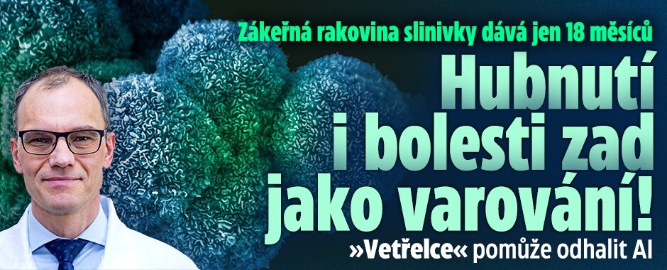 Hubnutí i bolesti zad jako varování: Zákeřná rakovina slinivky dává jen rok a půl! »Vetřelce« pomůže odhalit AI  
