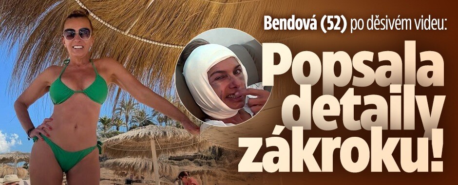 Bendová (52) po děsivém videu: Popsala detaily zákroku!