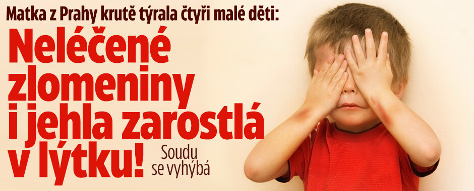 Matka z Prahy krutě týrala čtyři malé děti: Neléčené zlomeniny i jehla zarostlá v lýtku!
